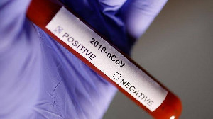 Hasil Penelitian Terhadap Kelelawar Lokal Negatif Virus Korona